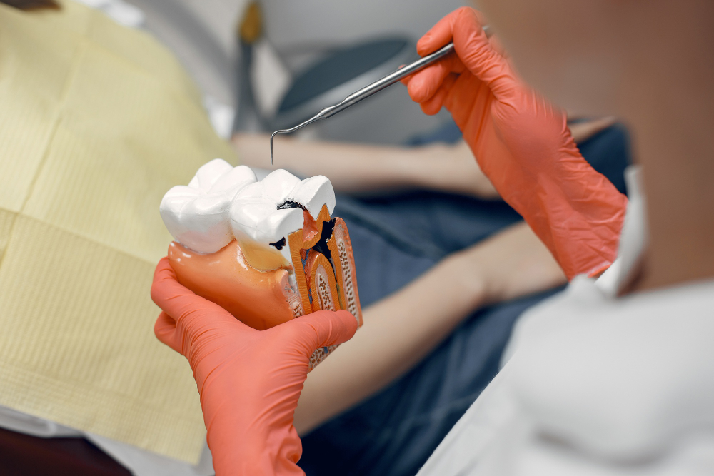 Root Canal Treatment in Hyderabad